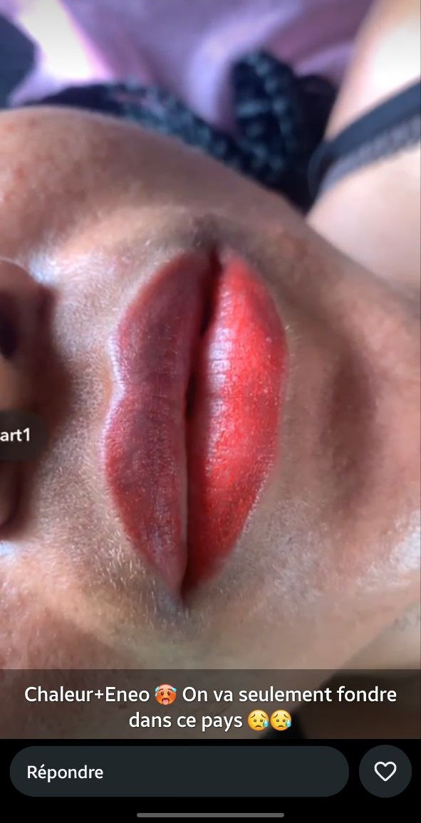 Micropigmentation